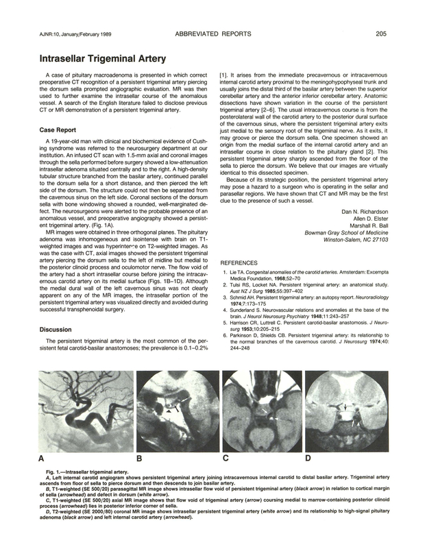 PDF extract preview