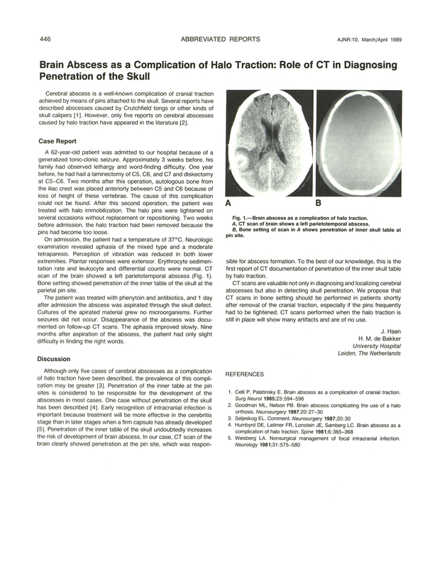 PDF extract preview