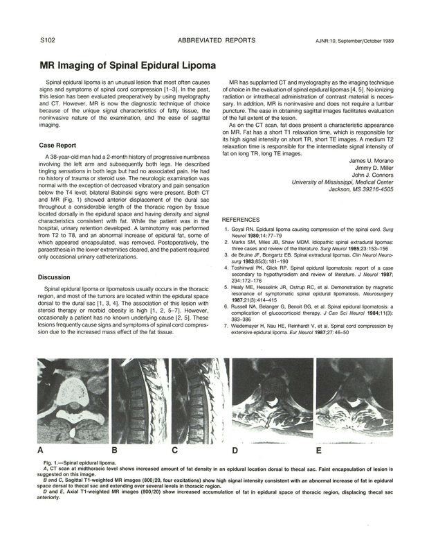 PDF extract preview