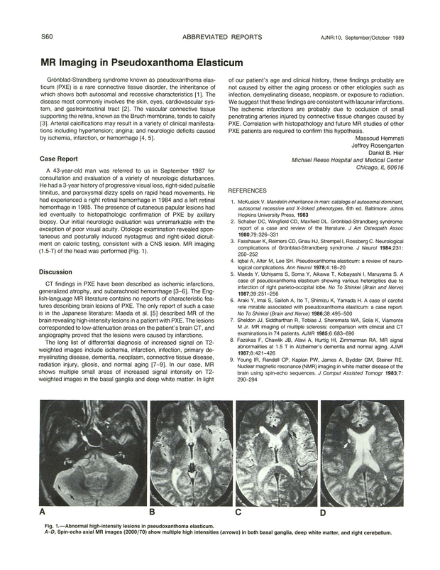 PDF extract preview