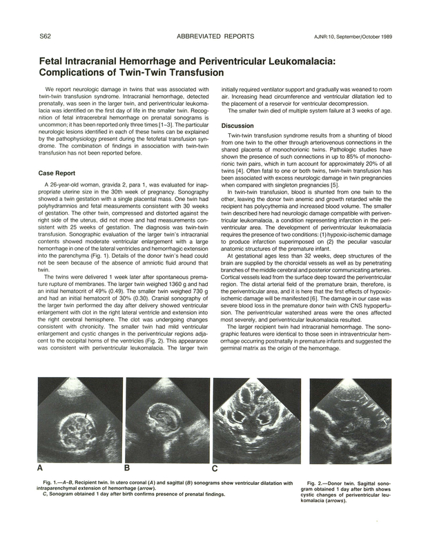 PDF extract preview
