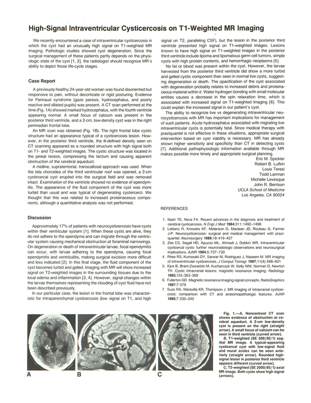 PDF extract preview