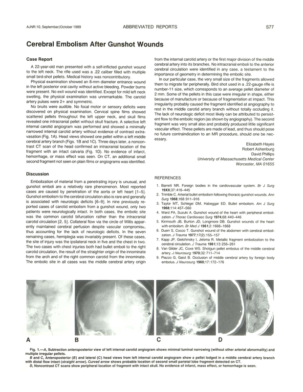 PDF extract preview