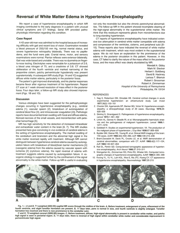 PDF extract preview