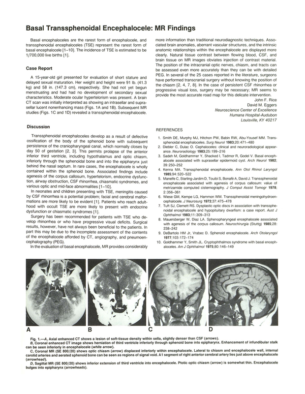 PDF extract preview