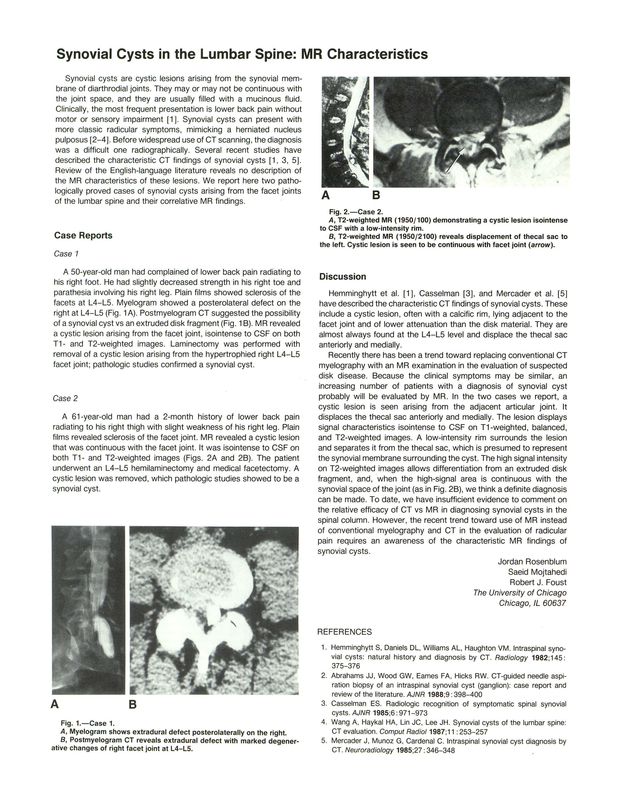PDF extract preview