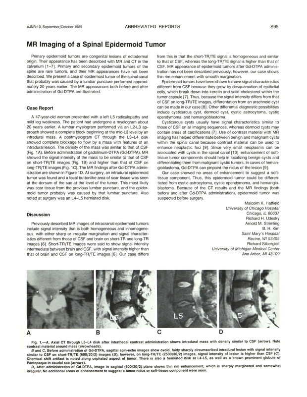 PDF extract preview
