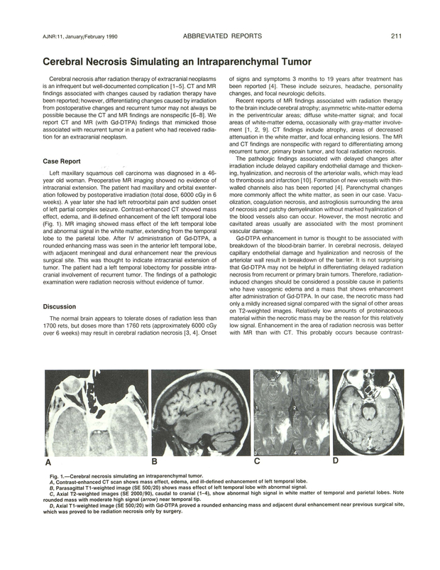 PDF extract preview