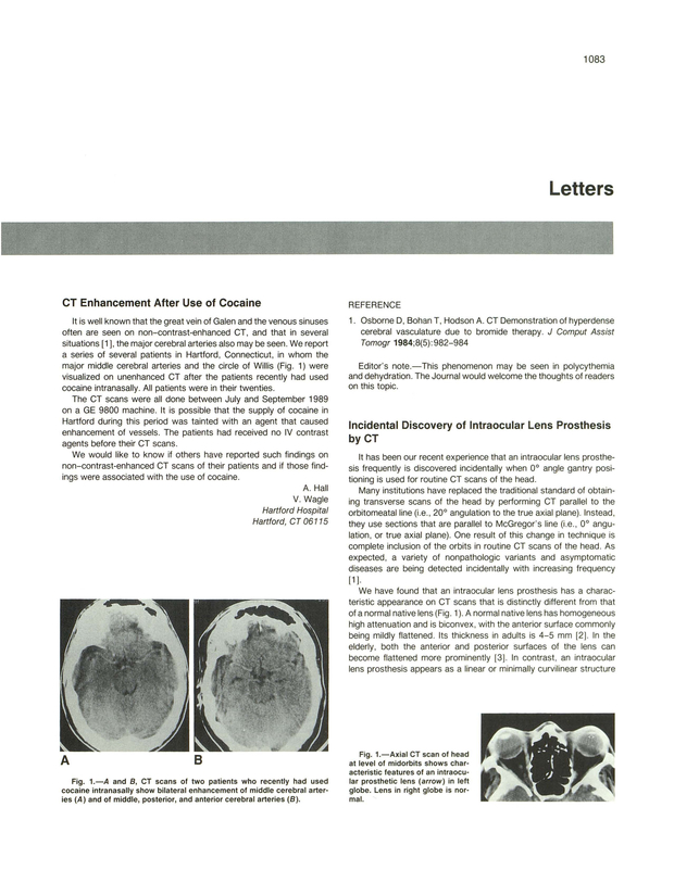 PDF extract preview