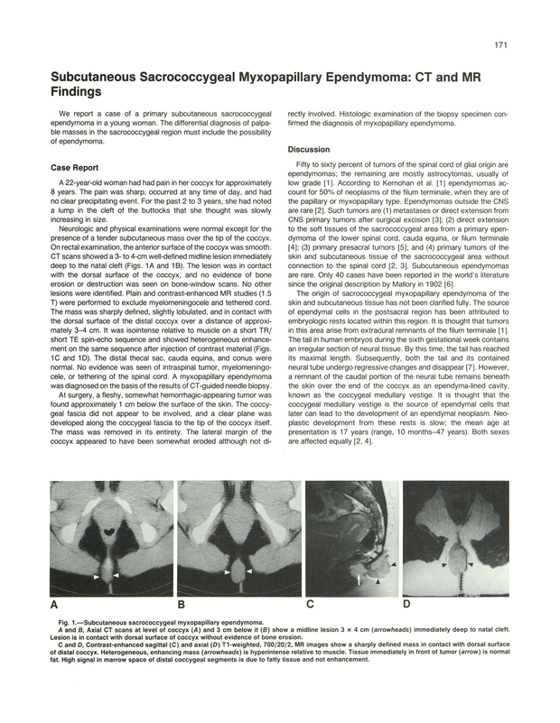 PDF extract preview