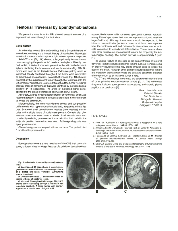 PDF extract preview