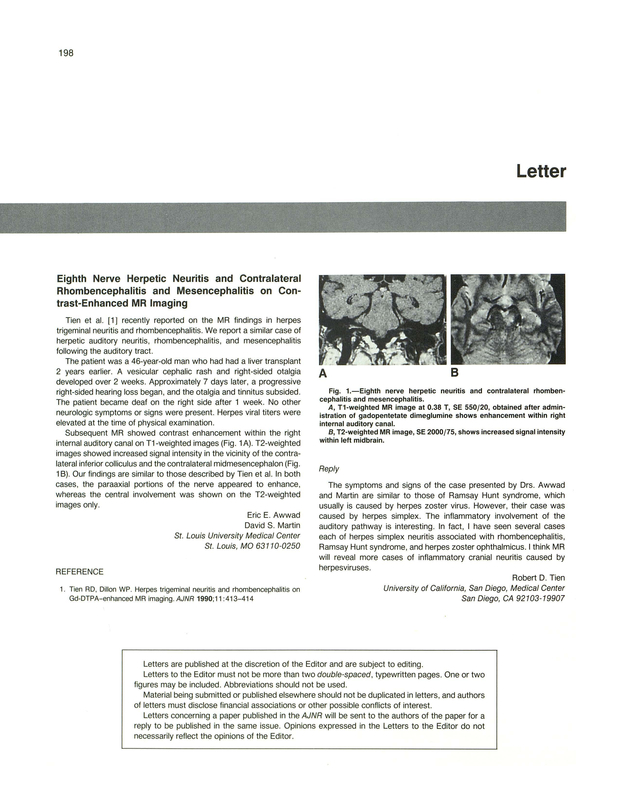 PDF extract preview