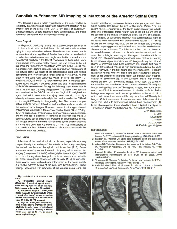 PDF extract preview