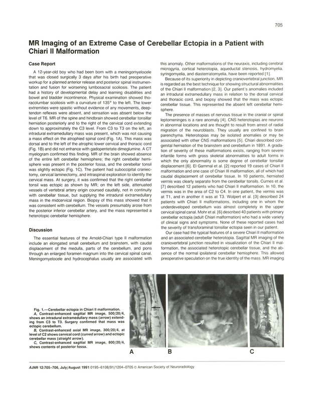 PDF extract preview