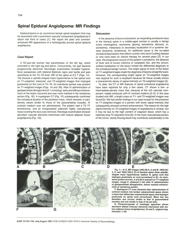 PDF extract preview