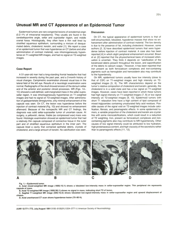 PDF extract preview