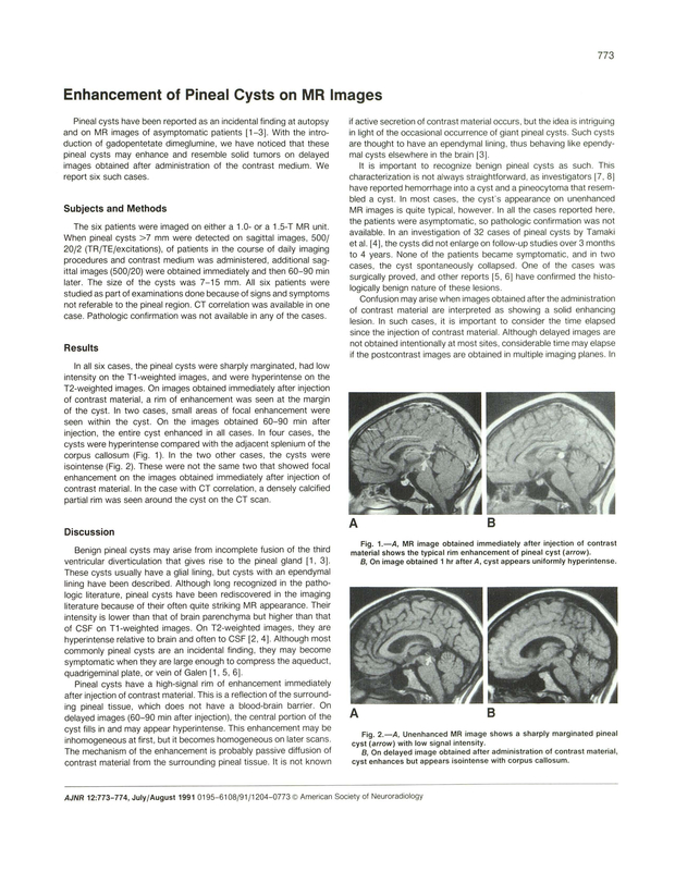 PDF extract preview