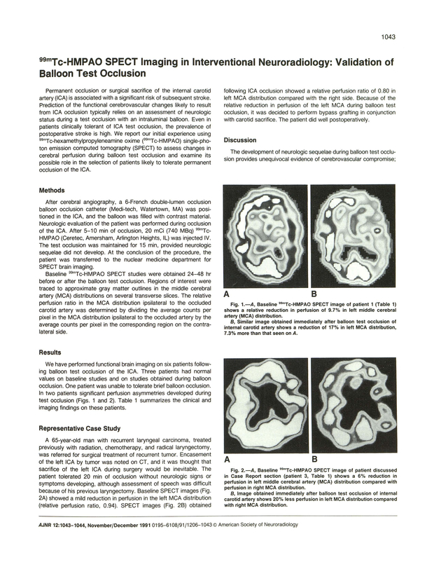 PDF extract preview