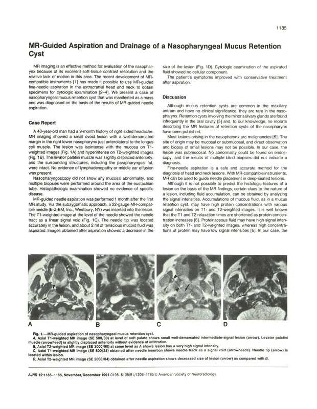 PDF extract preview