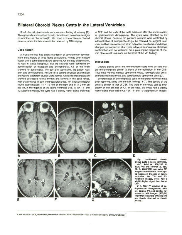 PDF extract preview
