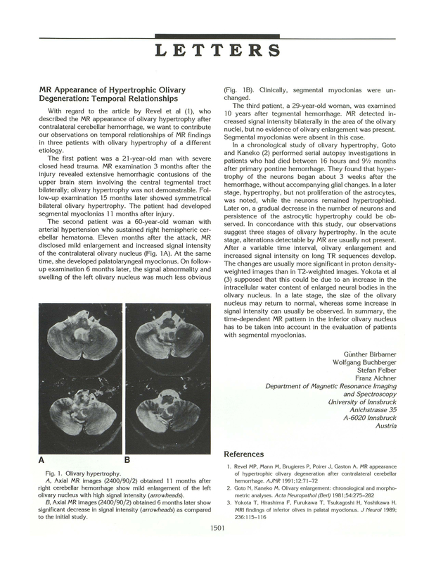 PDF extract preview