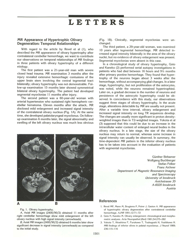 PDF extract preview