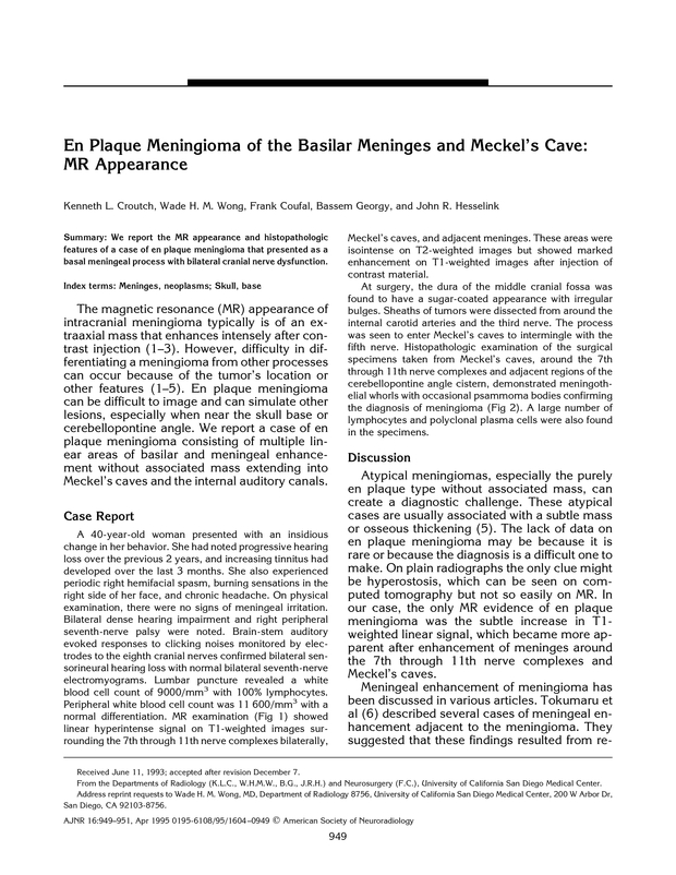 PDF extract preview