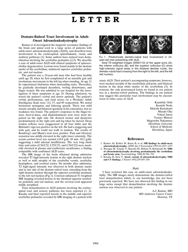 PDF extract preview