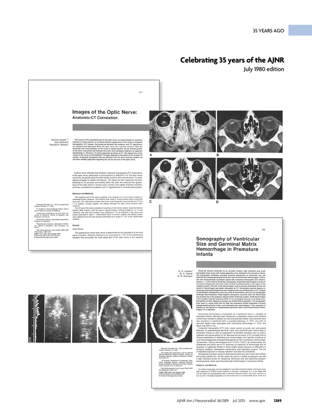 PDF extract preview