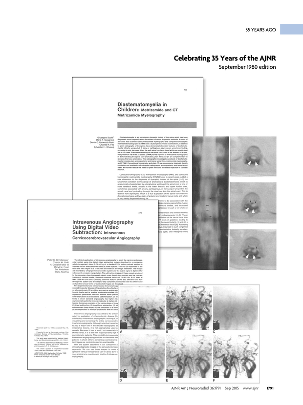 PDF extract preview