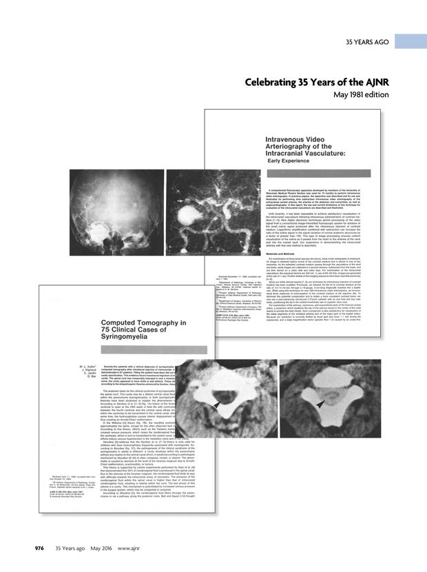 PDF extract preview