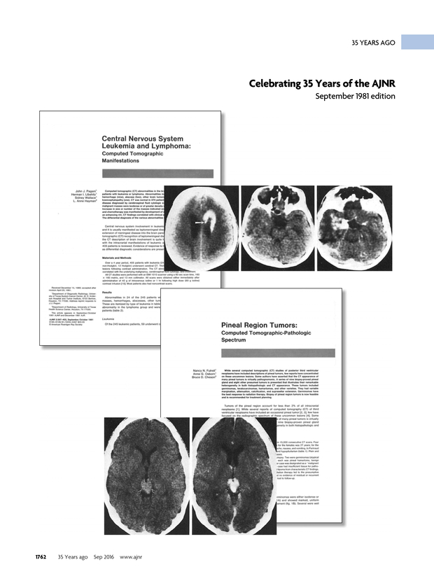 PDF extract preview
