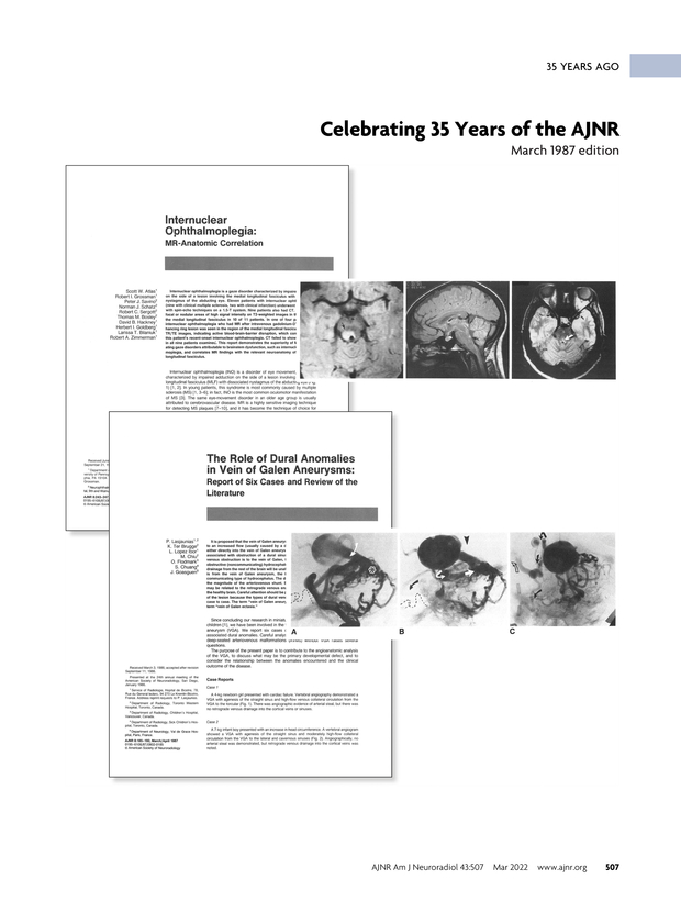PDF extract preview