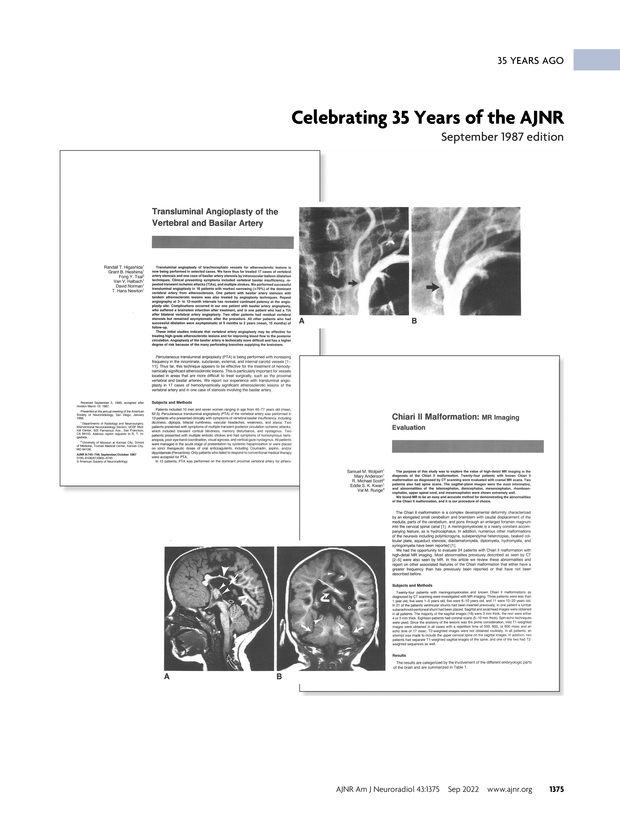PDF extract preview