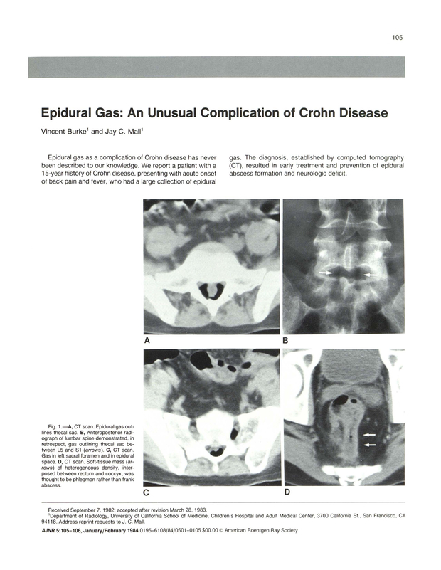 PDF extract preview