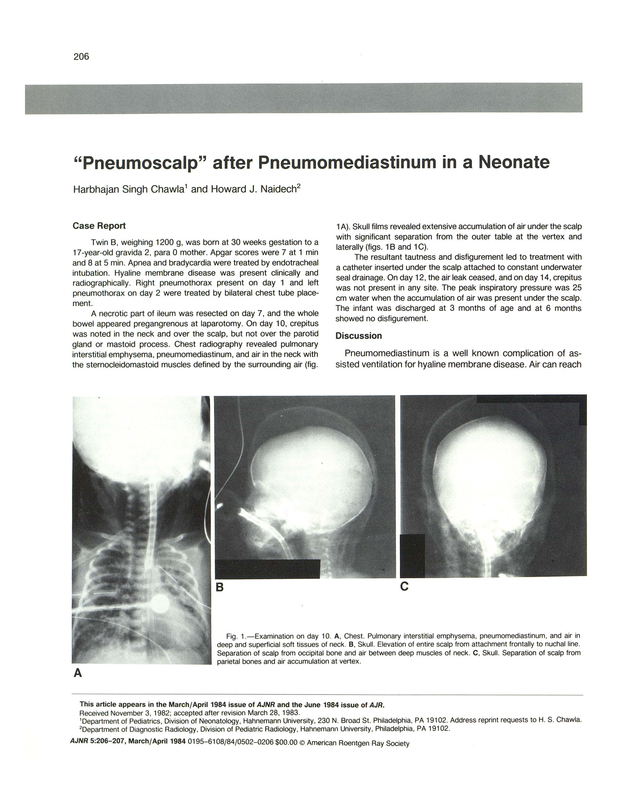 PDF extract preview