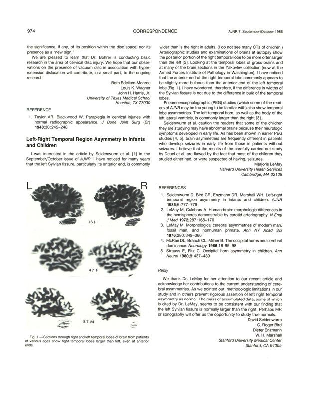PDF extract preview