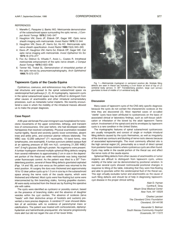 PDF extract preview