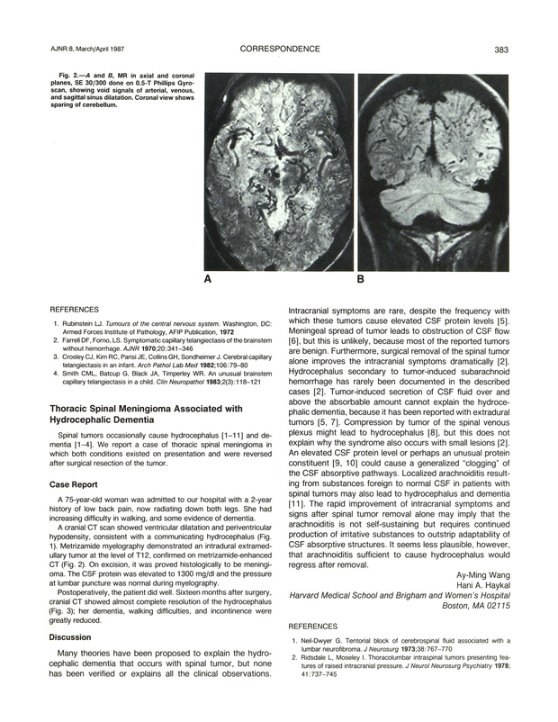 PDF extract preview