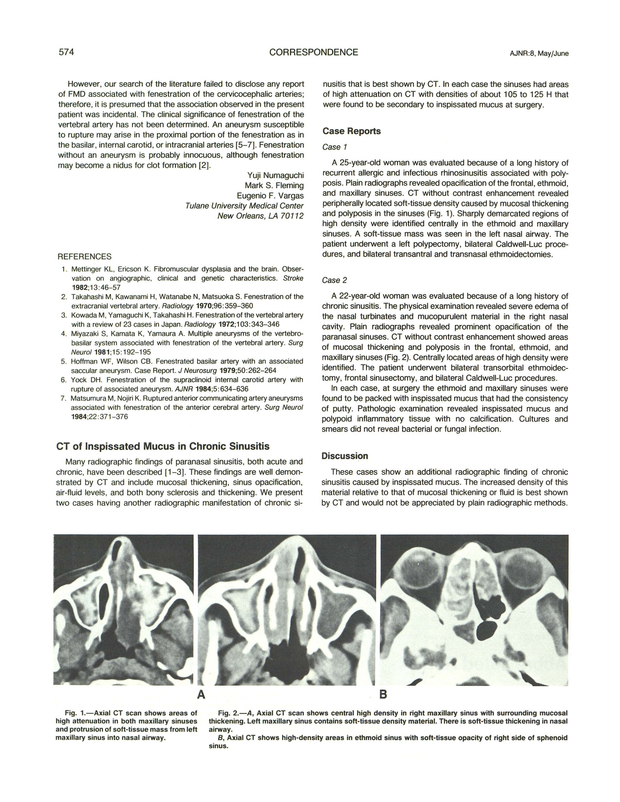 PDF extract preview