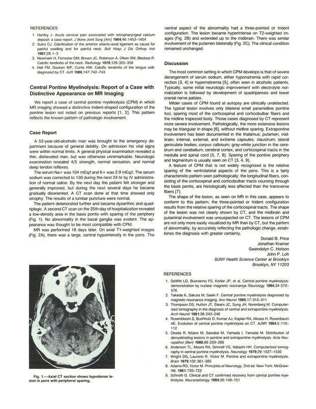 PDF extract preview