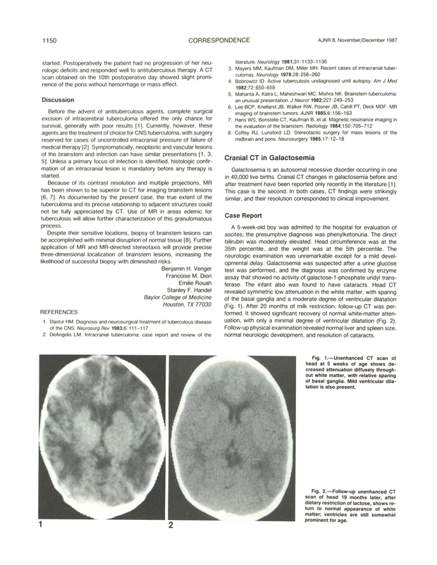 PDF extract preview