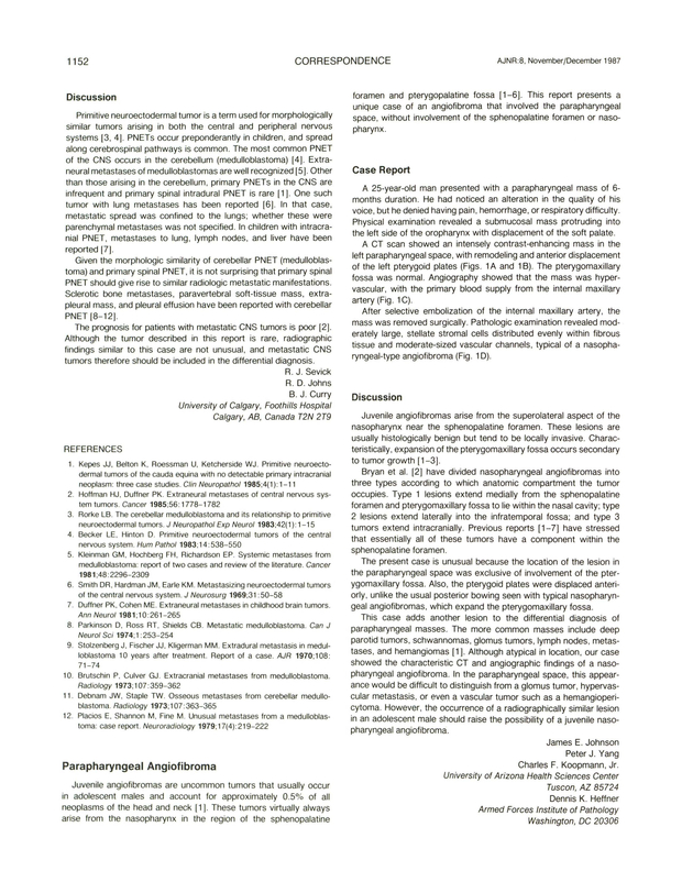 PDF extract preview