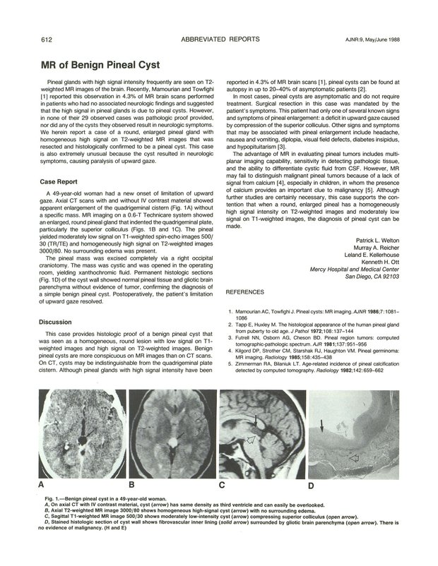 PDF extract preview