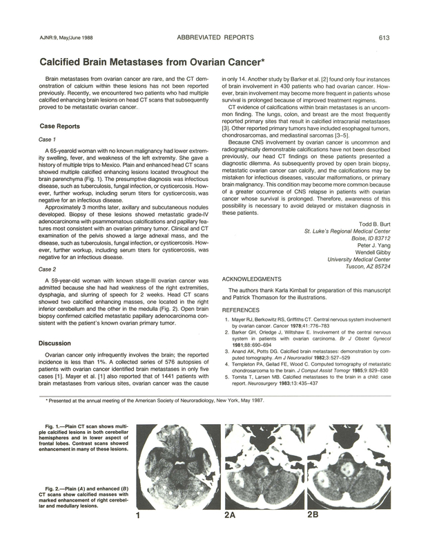 PDF extract preview