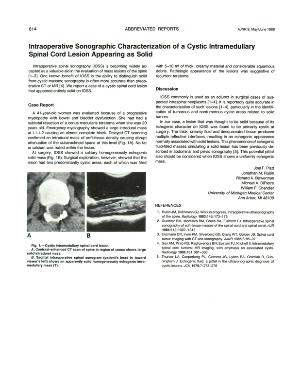 PDF extract preview