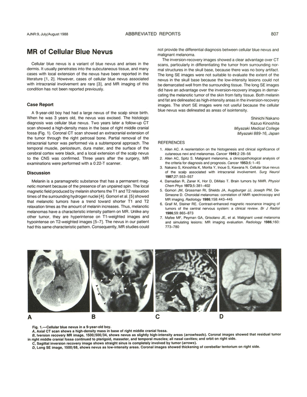 PDF extract preview