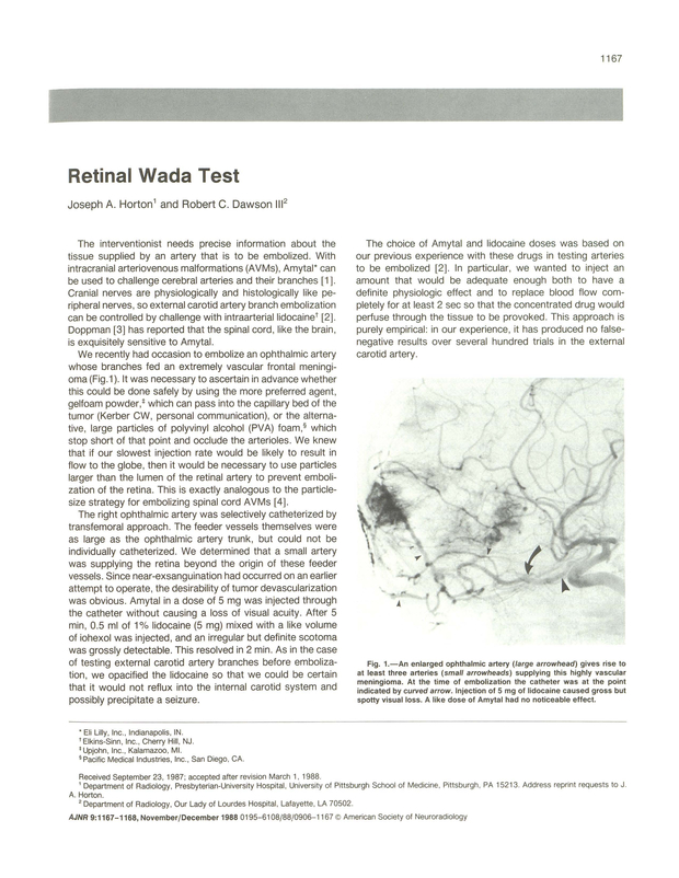 PDF extract preview
