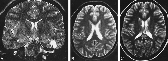 fig 2.