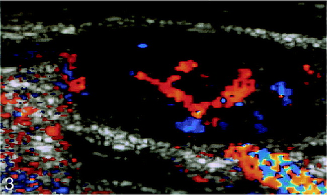 fig 3.